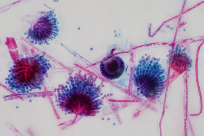 Aspergillus (mold) under the light microscopic view for education.