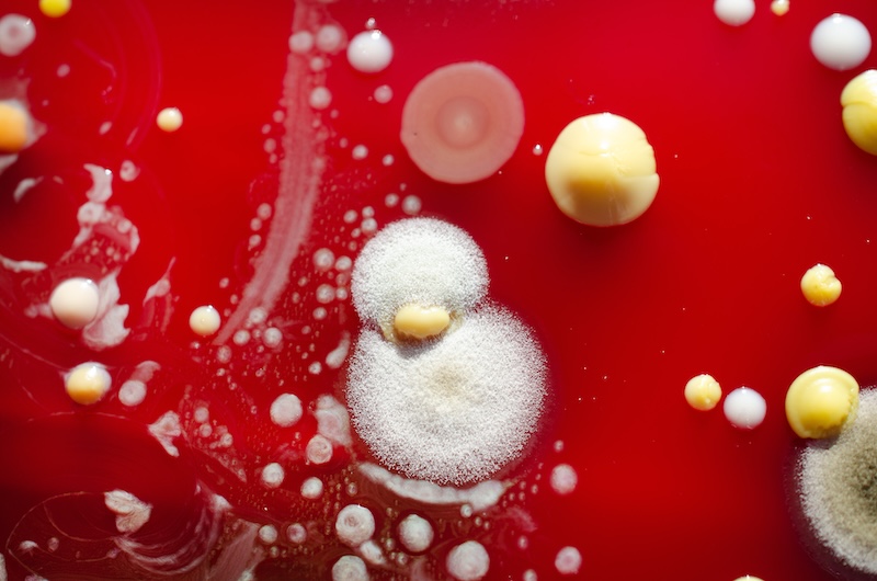 Bacterial and mold fungi colonies grown from indoor air on blood sheep agar, photograph showcasing microbial diversity and air contamination. SSUCv3H4sIAAAAAAAACnRSy27cMAy8F+g/LHTuovba60e/oJeghx6DHmiJWavRWoZEpSiC/fdSspUqTXMTh6Ph8PH88cPhICbwWoovh+cYcayNCZ4ckLYLw9WnHXe4KHQl8uSarioB0GWESpN1GkwJTkByXuCKDC7BmAjfUlJ4AgoefeHFz4EInScrHxmus4pyCFdPOsn8RXG1XtM6W7JRpS7EJRBe2M0r+dz6/RYfciIl+QenxHepcZEo9iKbrTDF1J32Eo2BBW3wIue3gu+ofUUwNEtw+PmO5yN5OP8R/jb9REmF5Pb48TLnC1v6HRu5FS06NAjb/O43qnj8xdO7ppZ3EgSlbTGCJ8seIqEplECv4ODVv9VpqZdLgVia0zlkJWnDQi66ErknYaxdYTJxSw9cBjM+g/dMVxkvF8XHZ69FncVS6mlXFYo3GcO6aYahrceur6vuNJ6beidsdzRr1kl2ssGwGgsKY9GXzby5sL5txmYY23xUb44tEtq2r5uC8O/dJc656saNUi4pFdKqHK2OjoRUg0I890epTnhsh1N/HOoBjzB2p6qDB2xH4IO4/QEAAP//AwBrx9//tQMAAA==